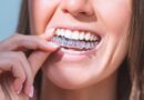 Invisalign dentist Aberdeen