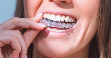 Invisalign dentist Aberdeen