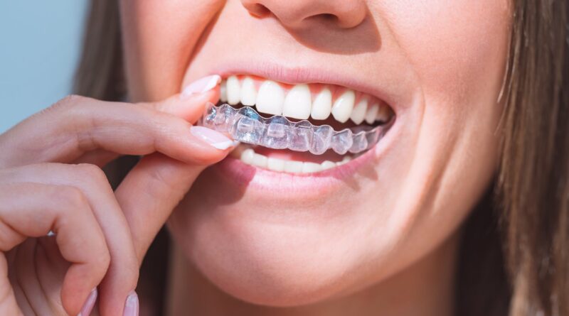 Invisalign dentist Aberdeen