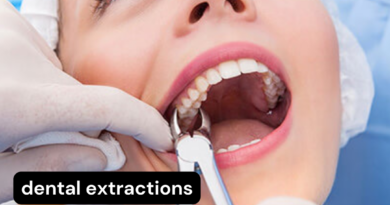 Dental Extractions