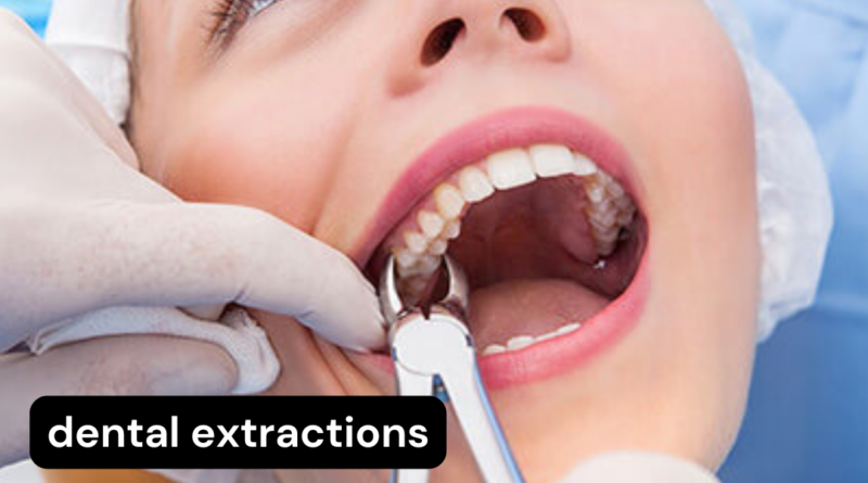 Dental Extractions