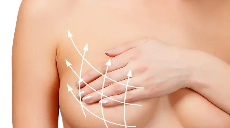 Breast Augmentation surgery in Dubai: How to Plan for a Smooth Recovery