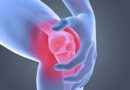 How to Relieve Quickly Knee Pain?