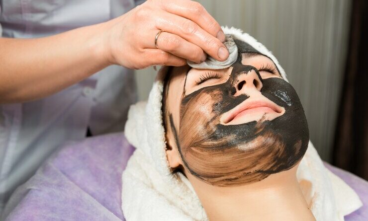 Chemical Peel for Acne Scars