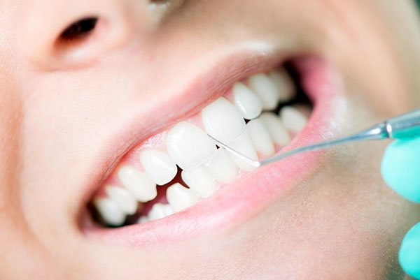 Gum Disease Treatment