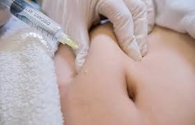 Lipotropic Injections