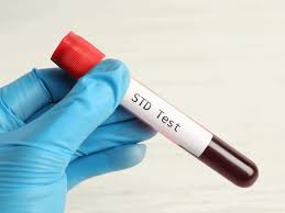 std test clinic dubai