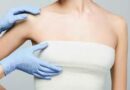 Top Reasons Women Opt for Breast Reduction in Dubai