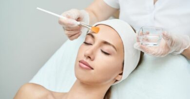 Chemical peel for Melasma