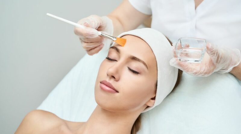 Chemical peel for Melasma