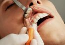 Understanding the Importance of Emergency Dental Care