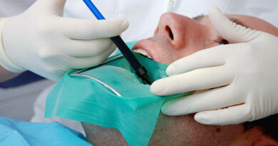 Root Canal Aftercare: How to Minimize Pain and Speed Up Healing