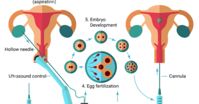 IVF Treatment