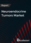 Future Landscape of the Neuroendocrine Tumors Market: Market Insights