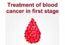 Blood cancer, also referred to as hematologic cancer, involves the abnormal growth of blood cells. The main types of blood cancer