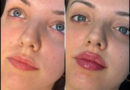 fillers@perfectdrs.com