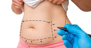 Tummy Tuck in dubai