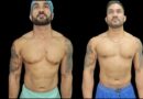 gynecomastia in dubai