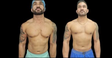 gynecomastia in dubai