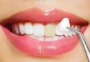 Best Dentists in Adelaide | Quality Care for Your Smile