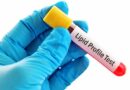 Lipid Profile Test