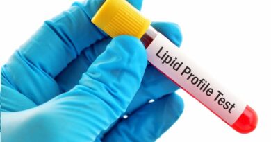 Lipid Profile Test