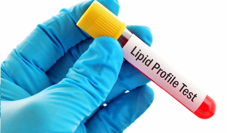 Lipid Profile Test